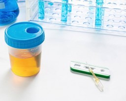 How Culture and Sensitivity Urine Testing Helps in Monitoring UTI Treatment Effectiveness?